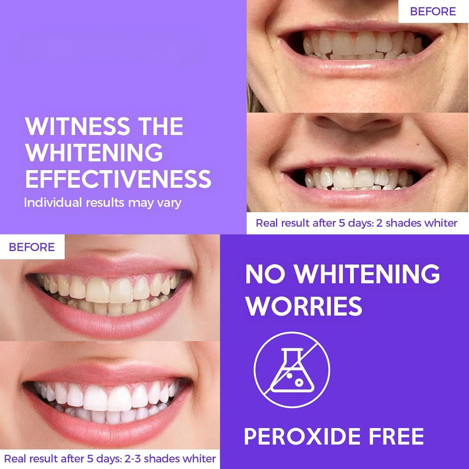 FreeGrin 7 Day Whitening Strips - 14 Pack (28 Strips) - Image 3
